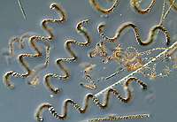 Anabaena crassa