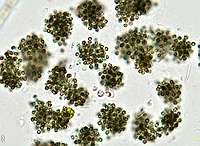 Microcystis botrys