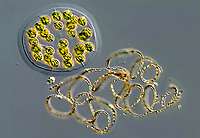 Anabaena mendote & Eudorina elegans