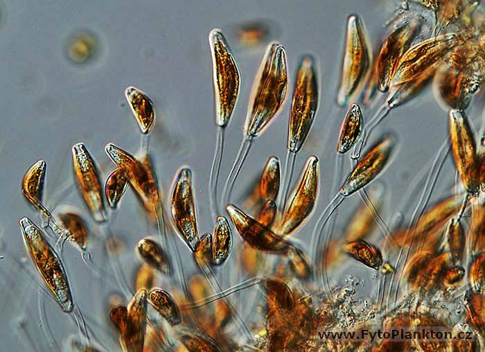 Cymbella sp.