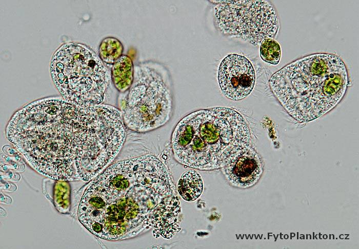 Halteria & Vorticella