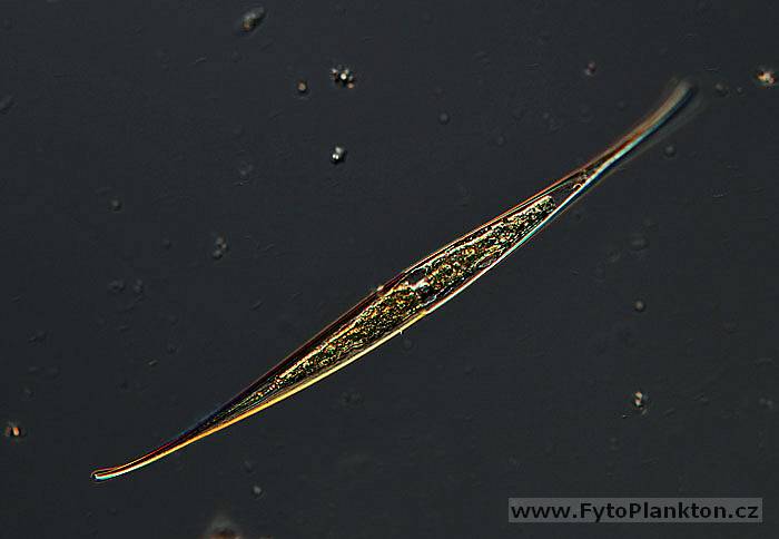 Closterium sp.