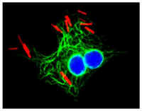 3T3-vinblastine.jpg (21422 bytes)