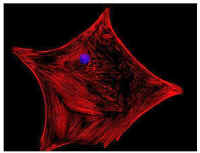 Leydig cell-actin.jpg (30609 bytes)