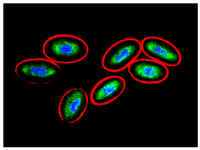 erythrocytes-vimentin.jpg (89509 bytes)
