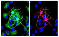 neurons-tubulin.jpg (30908 bytes)