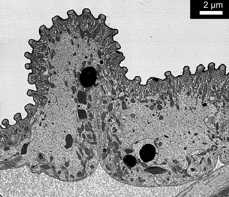 acinar duct II