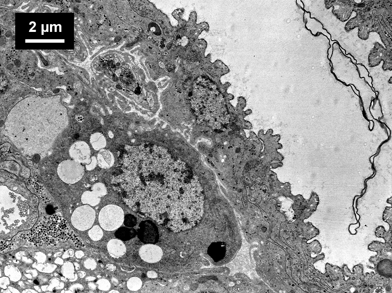 acinus, water sac and two nerves