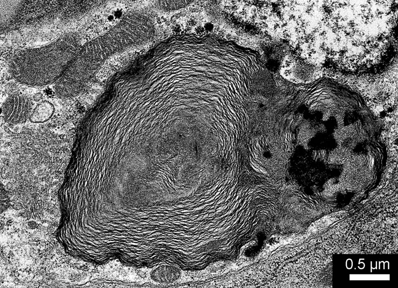 myelin figure in the parietal cell