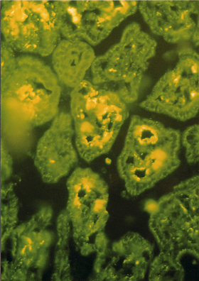 Molekuly HSP70 (proteiny tepelného šoku – Heat Shock Proteins), které 
<br/>vznikly při salmonelové infekci, jsou v histologickém řezu střevních klků obarveny fluorescencí. Tyto stresové 
<br/>proteiny jsou rozpoznávány pomocí buněčných receptorů TLR 2 a TLR 4 (zvětšeno 200). Blíže v textu. 
<br/>Foto I. Trebichavský
<br/>