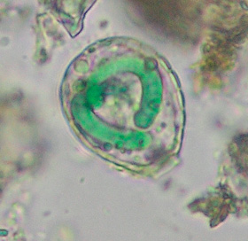 Sladkovodní krytenka Paulinella chromatophora ze skupiny Euglyphida (Rhizaria) obsahující dva modrozelené útvary – chromatofory, které představují endosymbioticky žijící redukované sinice (blíže v textu). Na obrázku je dobře viditelná křemičitá schránka krytenky. Foto T. Hauer