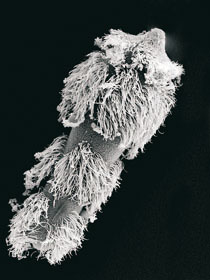 Obrvené miracidium motolice rodu Trichobilharzia (délka kolem 100 µm). Brvy slouží k pohybu ve vodním prostředí a hledání mezihostitelského plže. 
<br/>
<br/>Foto L. Houžvičková