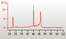 Total RNA profile rna profile