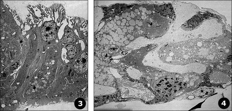 Fig. 3 and Fig. 4