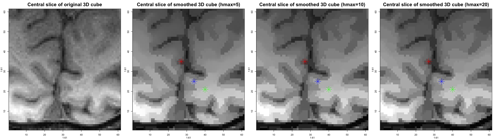 smoothing of a 3D MR-image using AWS