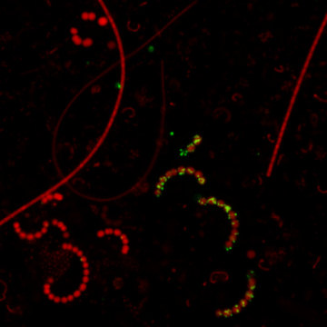 Fytoplankton v epifluorescenčním mikroskopu - červená autofluorescence chlorofylu zviditelňuje buňky řas a sinic, jejich extracelulární fosfatázy fluoreskují zeleně