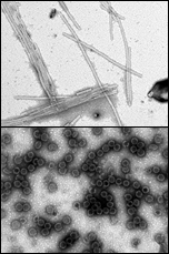 Assembly of retroviruses