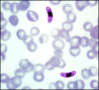 Plasmodium falciparum