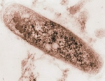 Mycobacterium tuberculosis