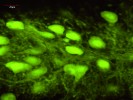 Mikrofotografie kůry mozečku  39 dnů staré myši Lurcher tři týdny  po transplantaci embryonální nervové tkáně ve formě solidního transplantátu odebráného z mozečku 12denního embrya GFP myši. V zobrazení fluorescenčním mikroskopem jsou patrny zeleně fluoreskující Purkyňovy buňky v ne zcela typickém uspořádání