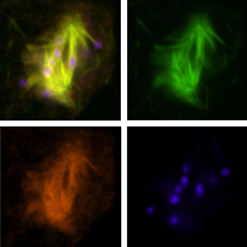 Dělící se buňka huseníčku rolního (Arabidopsis thaliana). Zeleně bílkovinná vlákna zvaná mikrotubuly, modře DNA, červeně bílkovina Aurora1 kináza. Foto Věra Cenklová.