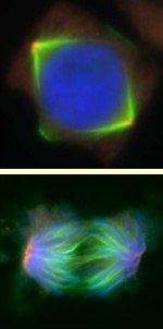 cytoskelet (vnitrobuněčná "kostra") v oblasti jader dělících se rostlinných buněk