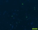  	Půdní bakterie zviditelněné  epifluorescenční mikroskopií  (modrá barva). Foto L. Kahounová