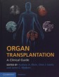 Organ Transplantation