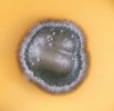 Kolonie houby Phialophora europaea na bramborovo-dextrózovém agaru, která vzhledem připomíná kolonie kvasinek, a proto bývá druh řazen do skupiny  tzv. black yeasts (blíže v textu). Izolát pochází z kožní léze na nártu. Foto V. Hubka