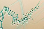 Konidiofor nesoucí drobné mikro­konidie a spirální vlákno (vlevo),  které je typické pro zástupce druhového komplexu Trichophyton mentagrophytes, ale i některé další druhy dermatofyt. Foto V. Hubka 