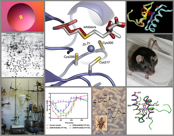 BHMT and inhibitor