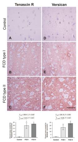 Imunohistochemická analýza ECM