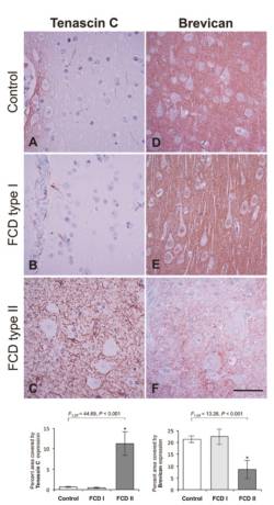 Imunohistochemická analýza ECM