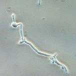 Candida