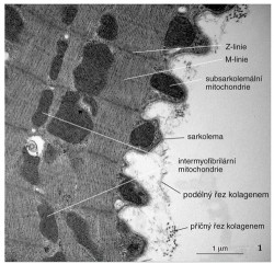 Podélný řez papilárním svalem z levé srdeční komory potkana v elektronovém mikroskopu. Papilární sval je maximálně kontrahovaný (zkrácený), což způsobilo zvlnění sarkolemy okolo subsarkolemálních mitochondrií (vpravo). Tyto mitochondrie zásobují energií Na/K-ATPázy na sarkolemě. Intermyofibrilární mitochondrie, uložené podélně mezi fibrilami, zásobují myozinové ATPázy a Ca-ATPázy sarkoplazmatického retikula. Délka sarkomery je zhruba poloviční (1,2 μm) ve srovnání s relaxovaným stavem. Aktinová a myozinová filamenta jsou do sebe zcela zasunuta, a tím vymizely světlé I-pruhy, které pozorujeme na relaxovaném svalu (obr. 2). Z-linie ohraničují sarkomeru a M-linie se nacházejí v jejím středu.  Vně kardiomyocytu (vpravo) jsou patrná vlákna kolagenu v podélném a příčném řezu. Blíže v textu. Foto B. Elsnicová