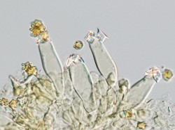 Shluky krystalů šťavelanu vápenatého na povrchu specializovaných buněk – cystid ve výtrusorodé vrstvě (hymeniu) vláknice tuřínonohé (Inocybe napipes)