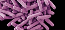 /sys/galerie-obrazky/news-2015/150428-bakterie-tuberkulozy.jpg