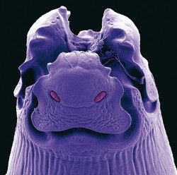 Přední konec těla hlístice (škrkavky) rodu Hysterothylacium. Snímek ze  skenovacího elektronového mikroskopu. Foto R. Kuchta a J. Nebesářová