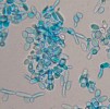 Mikroskopický snímek kvasinkového biofilmu (typická je tvorba pseudohyf) barveného alciánovou modří.  Kvasinkové buňky rostoucí ve formě  biofilmu produkují pouze malé množství extracelulární hmoty, která je těsně obklopuje. Foto V. Holá