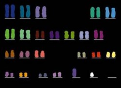 Karyotyp člověka po aplikaci techniky mnohobarevné fluorescenční in situ hybridizace (mFISH), která umožňuje detailnější analýzu jednotlivých chromozomových změn. Foto P. Kuglík