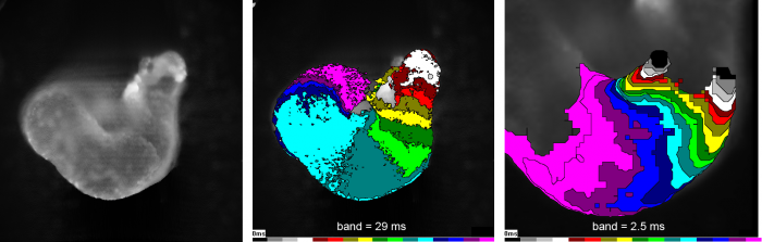 Cardiovascular Morphogenesis