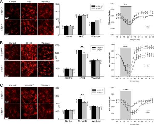 normální laminární distribuci neuronů u nemalformované kůry