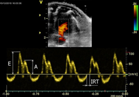 Developmental Cardiology