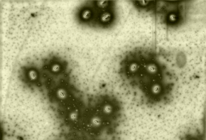 Bakterie E. coli zachycené na povrchu SPR biosenzoru (snímek z el. mikroskopu).