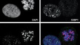 Fig. 1.Cells were exposed to ionizing radiation and stained for markers of DNA damage. Nuclear foci positive for gH2AX and 53BP1 are present in interphase cells, whereas mitotic cell fail to form 53BP1 foci. For detaild explanation see Benada et al. Cell Cycle, 2015.