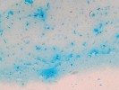 Mikroskopický snímek biofilmu  Staphylococcus epidermidis, barveno alciánovou modří, která se selektivně váže na polysacharidy. Stafylokoky  rostoucí ve formě biofilmu produkují velké množství extracelulárních poly­sacharidů – na obr. dobře patrná  polysacharidová biofilmová vrstva  obklopující shluky stafylokokových buněk. Foto V. Holá