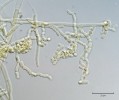 Šedopórka osmahlá (Bjerkandera adusta; Basidiomycota). Mycelium rozpadající se na válcovité nepohlavní spory. Foto O. Koukol