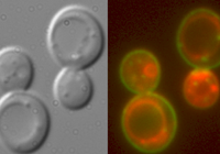 Membrane Transport