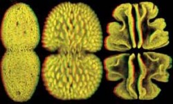 Rozdíly v povrchové struktuře chloroplastů řas krásivek (Desmidiales). Vlevo rod Euastrum s hrubým povrchem chloroplastu. Uprostřed a napravo krásivky rodu Cosmarium s povrchem chloroplastu rozděleným do mnoha malých hrbolků (uprostřed) či několika velkých laloků (vpravo). Foto B. Gunning / © B. Gunning