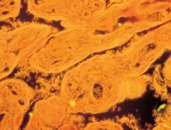 Trofoblast lidské placenty (klky zbarveny imunofluorescencí, mateřská krev je tmavá). Trofoblast chrání plod před imunitní reakcí matky. Tato specializovaná tkáň diferencuje účinkem syncytinu, obalového proteinu HERV-W endogenního lidského retroviru. Zvětšení 250X. Foto I. Trebichavský / © I. Trebichavský